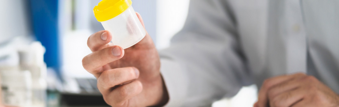 ako-sa-pouziva-domaci-test-plodnosti