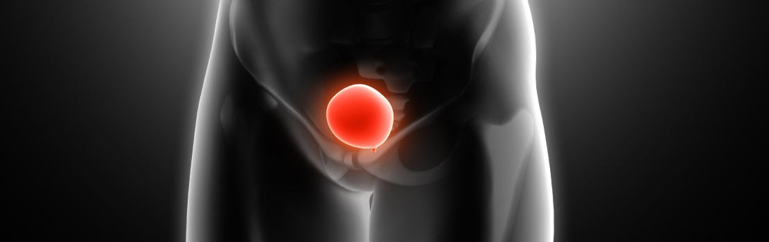 Pohár piva a symbol mužskej prostaty s upozornením na možné riziká